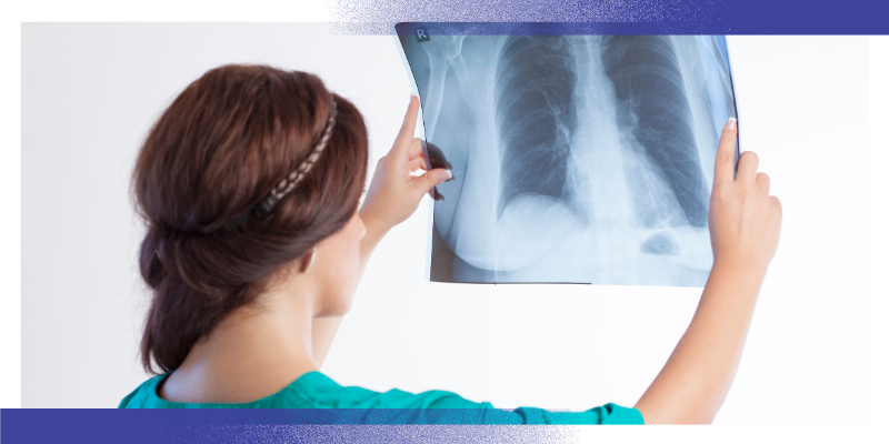 A person holds up a chest X-ray image and examines the lungs. The image highlights the use of medical imaging to identify and monitor lung nodules and other lung conditions, supporting the follow-up and early detection of diseases such as lung cancer.
